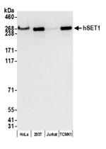 hSET1 Antibody in Western Blot (WB)