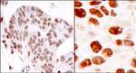 hnRNP-K Antibody in Immunohistochemistry (IHC)