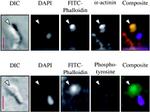 Phosphotyrosine Antibody in Immunocytochemistry (ICC/IF)