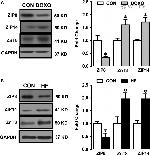 ZIP14 Antibody in Western Blot (WB)