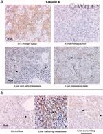 Claudin 4 Antibody in Immunohistochemistry (IHC)