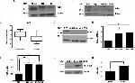 KLF6 Antibody in Western Blot (WB)