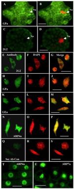 Actin Antibody in Immunocytochemistry (ICC/IF)