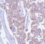 delta Catenin Antibody in Immunohistochemistry (Paraffin) (IHC (P))