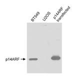 p14ARF Antibody in Western Blot (WB)