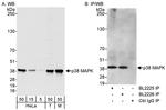 p38 MAPK Antibody in Western Blot (WB)