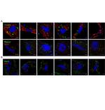 ERp57 Antibody in Immunohistochemistry (IHC)