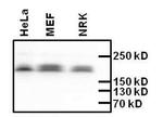 SMARCA2 Antibody in Western Blot (WB)