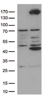 RET Antibody in Western Blot (WB)