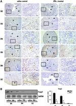 FOXP3 Antibody in Immunohistochemistry (IHC)