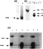 Phosphotyrosine Antibody in Western Blot (WB)