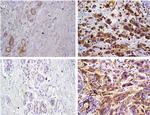 Fascin Antibody in Immunohistochemistry (IHC)