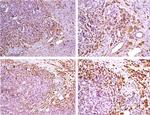 Fascin Antibody in Immunohistochemistry (IHC)