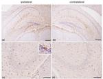 GFAP Antibody in Immunohistochemistry (IHC)