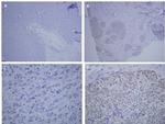 Estrogen Receptor beta Antibody in Immunohistochemistry, Immunohistochemistry (Paraffin) (IHC, IHC (P))