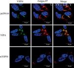 Golgin-97 Antibody in Immunocytochemistry (ICC/IF)