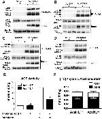 PMP70 Antibody in Western Blot (WB)