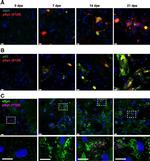 alpha Synuclein Antibody in Immunocytochemistry (ICC/IF)