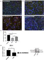 Claudin 5 Monoclonal Antibody (4C3C2), Alexa Fluor™ 488 (352588)