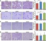 CD8 Antibody in Immunohistochemistry (IHC)