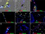 MYOD Antibody in Immunohistochemistry (IHC)