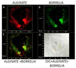 Borrelia burgdorferi Antibody in Immunohistochemistry (IHC)