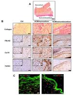 Fibulin 2 Antibody in Immunohistochemistry (IHC)