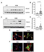 Fibulin 2 Antibody in Western Blot, Immunocytochemistry (WB, ICC/IF)