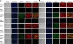 Biglycan Antibody in Immunocytochemistry, Immunohistochemistry (ICC/IF, IHC)