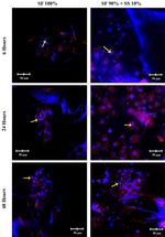 ITGB1 Antibody in Immunocytochemistry (ICC/IF)