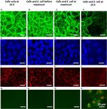 ZO-1 Antibody in Immunocytochemistry (ICC/IF)