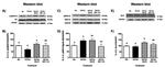 Phospho-AKT1 (Ser473) Antibody in Western Blot (WB)