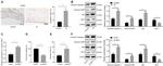 PARP1 (cleaved Asp214, Asp215) Antibody in Western Blot (WB)