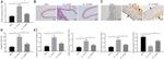 PARP1 (cleaved Asp214, Asp215) Antibody in Western Blot (WB)