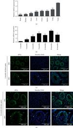 eIF2 gamma Antibody in Immunohistochemistry (IHC)