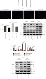 eIF2 gamma Antibody in Western Blot (WB)