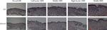 VEGF Antibody in Immunohistochemistry (IHC)