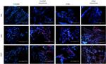 PD-L1 Antibody in Immunohistochemistry (IHC)