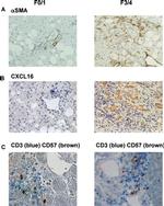 CD3 Antibody in Immunohistochemistry (IHC)