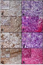 CD45 Antibody in Immunohistochemistry (IHC)