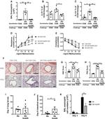 IL-13 Antibody in Immunohistochemistry (IHC)