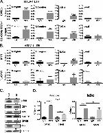 CBP Antibody in Western Blot (WB)