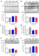 Nitrotyrosine Antibody in Western Blot (WB)