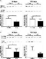 ATP1A1 Antibody in Western Blot (WB)