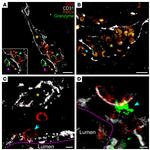 CD8 Antibody in Immunohistochemistry (IHC)