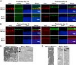 PDE6B Antibody in Immunohistochemistry (IHC)