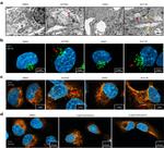 GRP94 Antibody in Immunocytochemistry (ICC/IF)