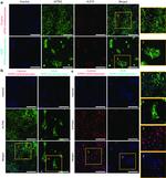 SERCA2 ATPase Antibody in Immunocytochemistry (ICC/IF)