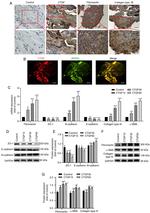 RPE65 Antibody in Immunocytochemistry, Immunohistochemistry (Paraffin) (ICC/IF, IHC (P))