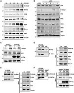 IKK beta Antibody in Western Blot, Immunoprecipitation (WB, IP)